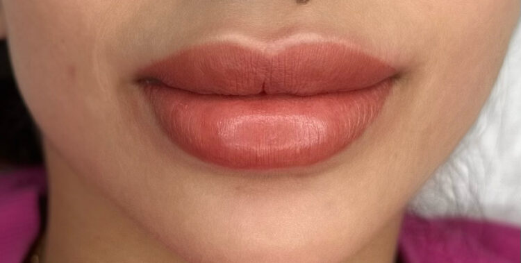 What is Dark Lip Neutralization? And How to Get the Best Treatment in Egypt